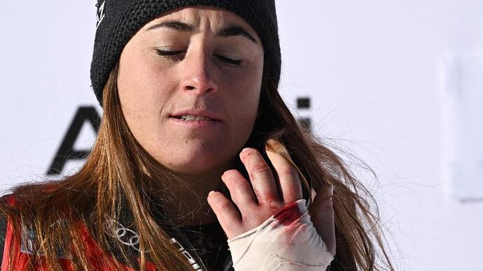 sofia-goggia-zeigt-ihre-verletzte-hand-die-italienerin-sorgte-fuer-eine-ski-sensation